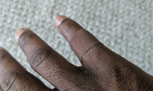 ある黒人男性が絆創膏に感動した理由に考えさせられる...