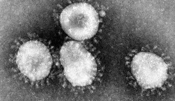 SARSをすでに超えている？！”コロナウイルス”に関するある中国人医師が世界に向けメッセージが恐ろしすぎる...